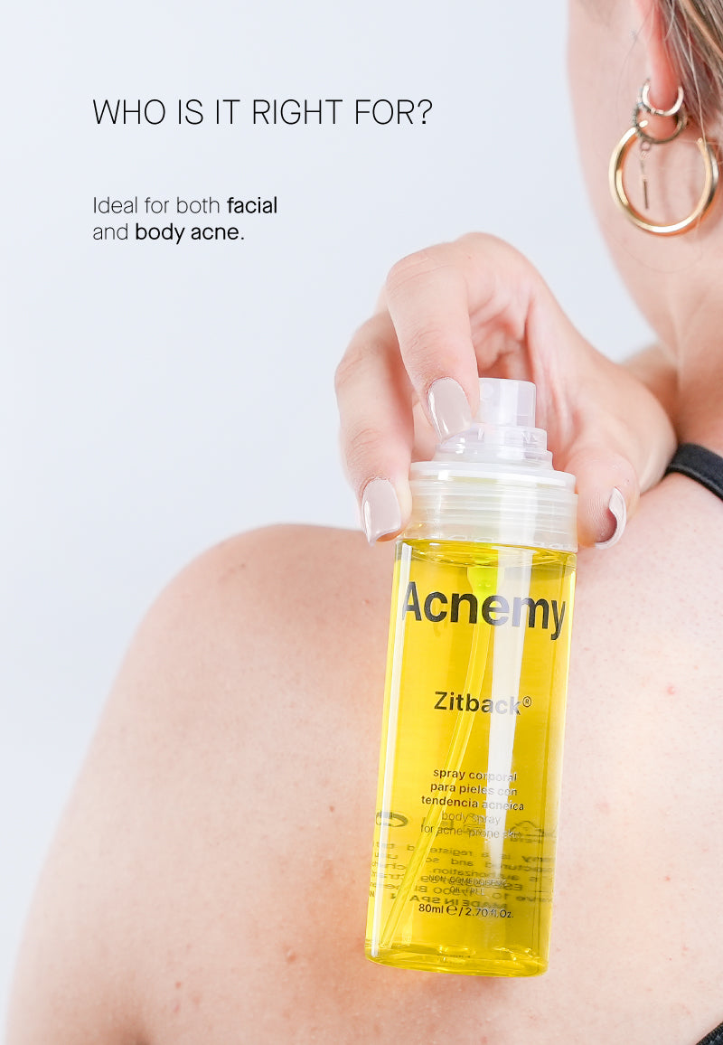 Acnemy - Zitback®