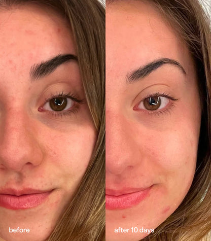 Bubble Brightening Eye Cream