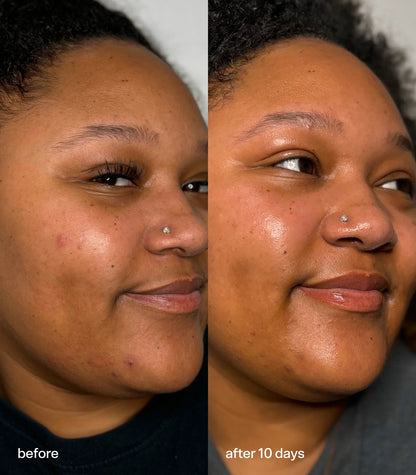 Bubble Skincare Super Hydrating Moisturizer